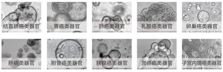 類(lèi)器官構(gòu)建及生物樣本庫(kù)建立